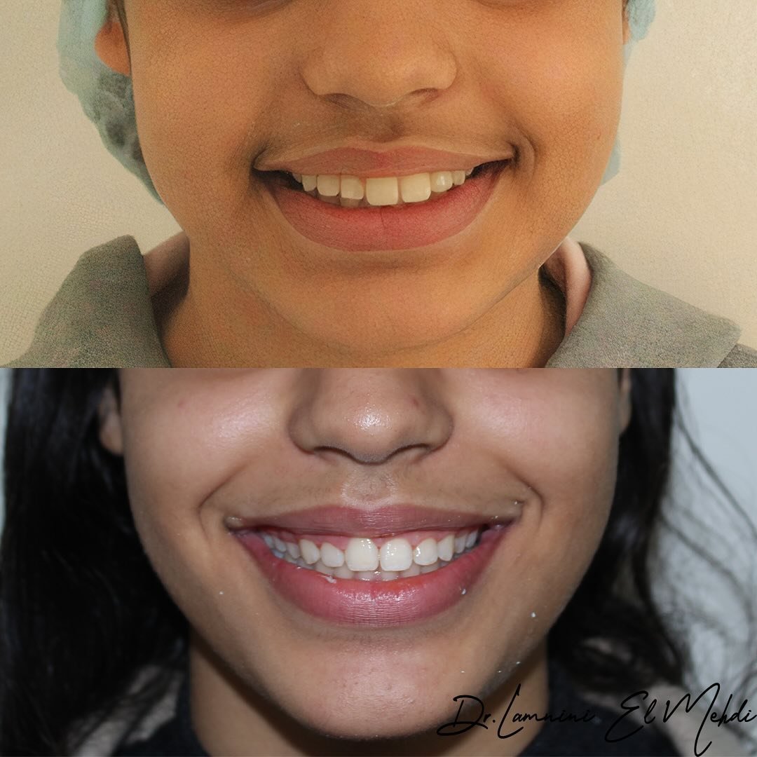 Image pour Centre dentaire les facettes du sourire Dr Douae ARBOUCH et Dr Lamnini El Mehdi